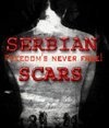     / Serbian Scars    